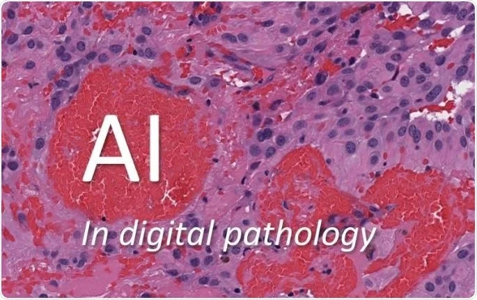 Digital Pathology AI News Today: How AI Is Reshaping Pathology in 2026